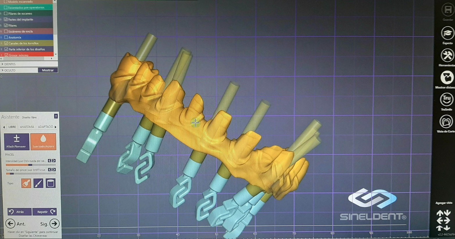 Tecnología CAD-CAM dental