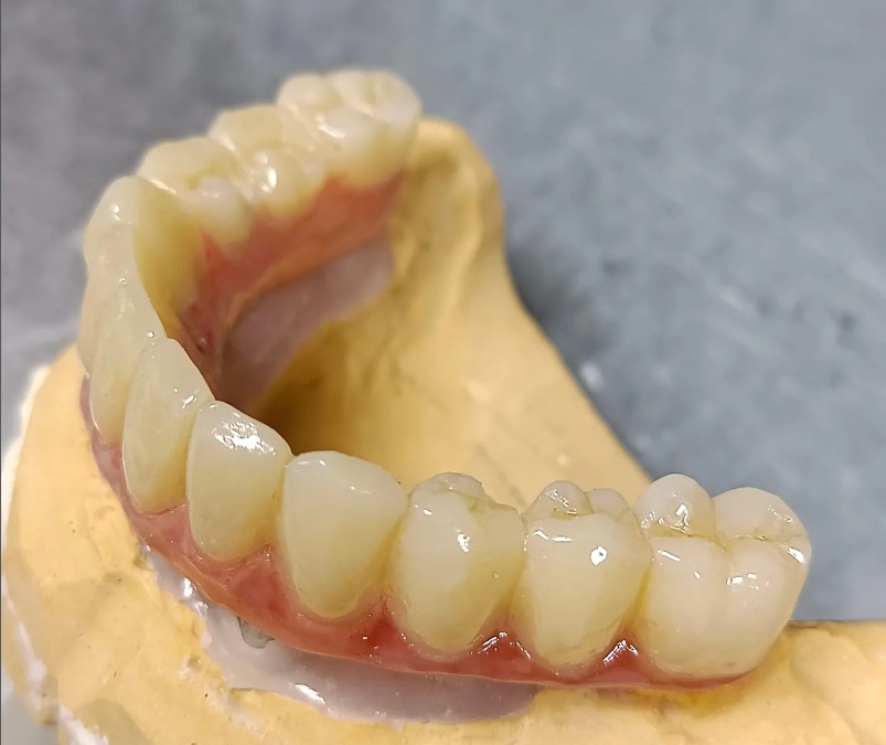 Tecnología CAD-CAM dental